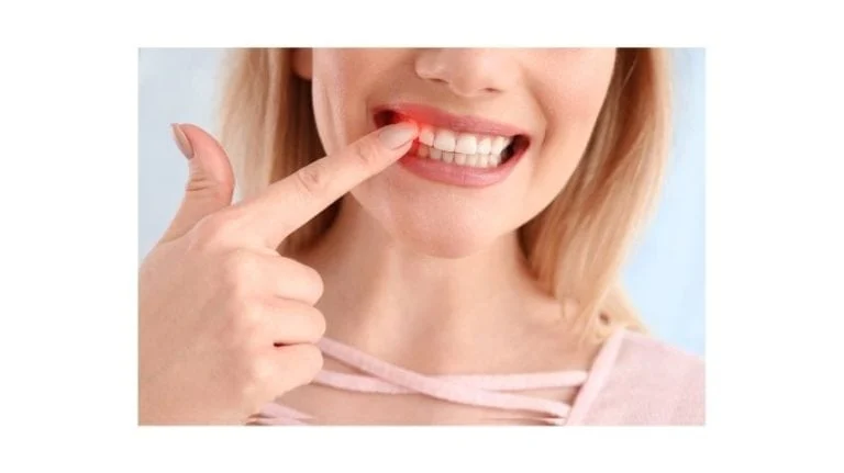 Diş Sağlığı: Evde Uygulayabileceğiniz Pratik Yöntemler